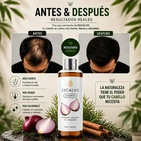 Shampo excalvo 300ml mas tonico x60ml