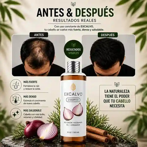 Shampo excalvo 300ml mas tonico x60ml